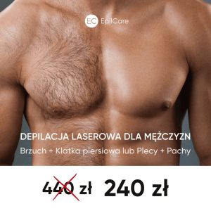 Reklama salonu depilacji laserowej EpilCare w Warszawie